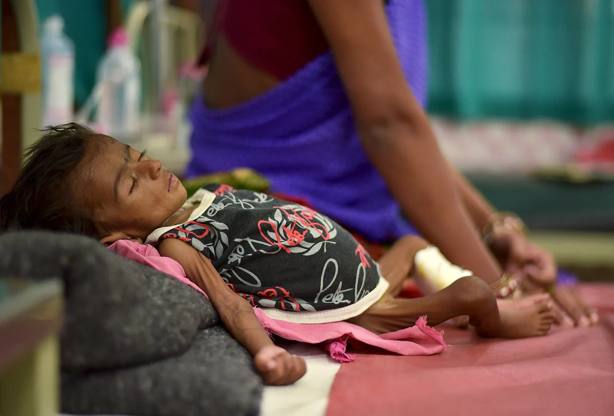 Two-month-old Jyoti lies in a bed in a malnutrition intensive care unit in Dharbhanga Medical College in Dharbhanga in the eastern state of Bihar, India, April 16, 2015. Despite India's economic boom over the last two decades, 46 percent of its children under five are underweight, 48 percent are stunted and 25 percent are wasted, according to the latest government figures. But what is not so widely known is that the majority are girls - abandoned, neglected or given less nutritious food than their male siblings, say health workers, attributing it to patriarchal attitudes in the country. Picture taken April 16, 2015. Photo: Reuters