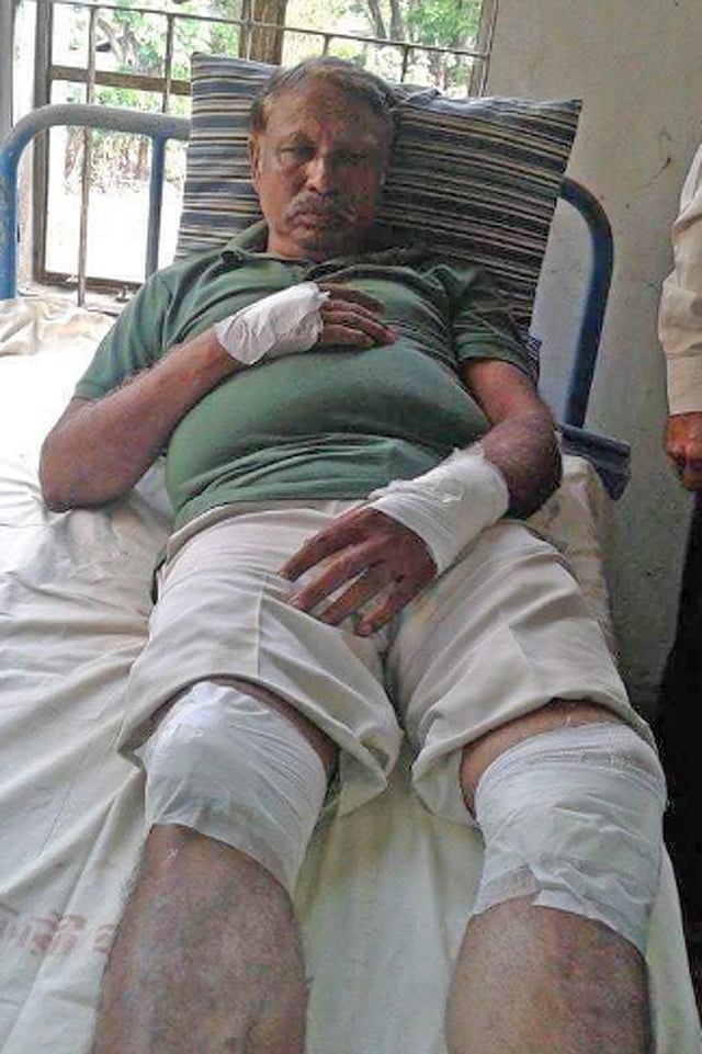 An injured of Sandwip clash. Photo: Prothom Alo