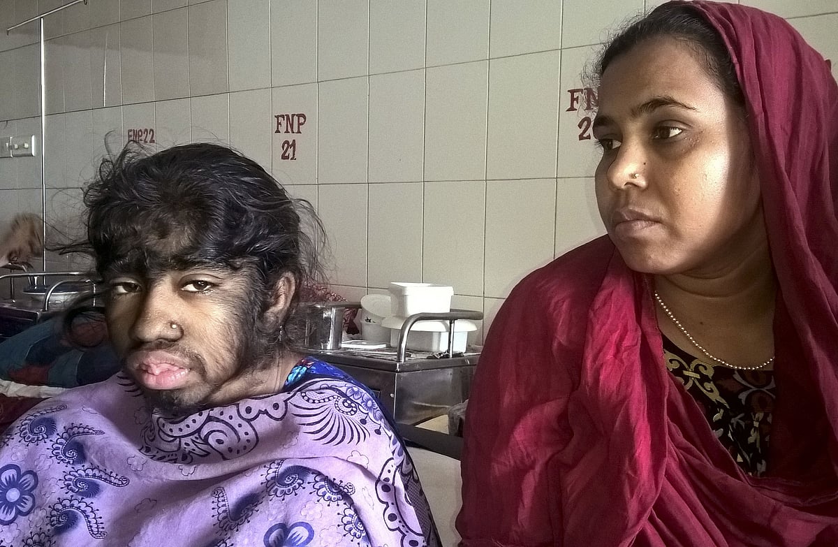 Bangladeshi patient Bithi Akhtar (L) and her mother wait in a ward at a hospital in Dhaka on May 12, 2016. AFP