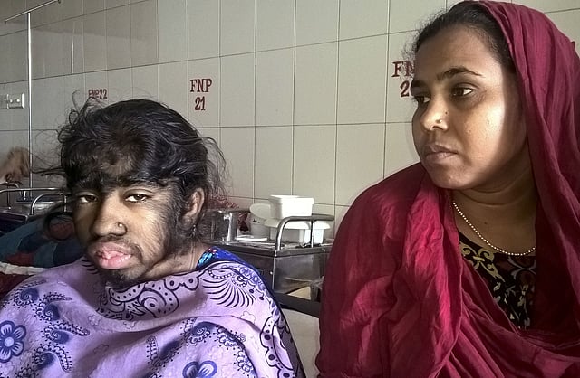 Bangladeshi patient Bithi Akhtar (L) and her mother wait in a ward at a hospital in Dhaka on May 12, 2016. AFP