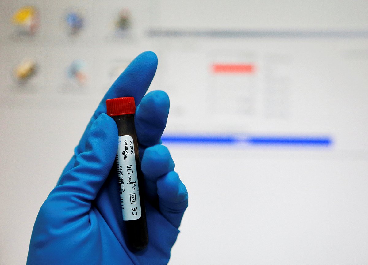 What is a “negative” dope test, how long does it take to detect drugs?