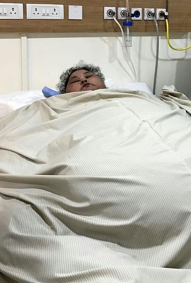 This handout photograph released by The Saifee Hospital on March 9, 2017, shows Egyptian patient Eman Ahmed Abd El Aty as she lies in a hospital bed at The Saifee Hospital in Mumbai on February 11, 2017, ahead of an operation. AFP