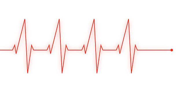 Heartbeat image collected