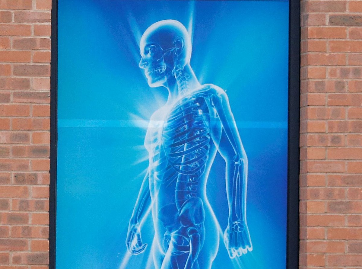 Representational image.