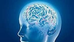 Representational image