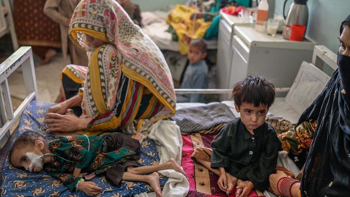 A child suffering from malnutrition receives treatment at the Mirwais hospital in Kandahar on 27 September, 2021