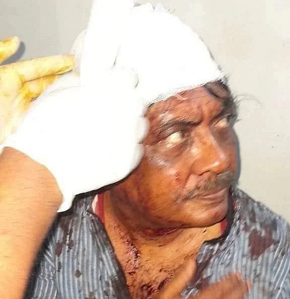 BNP vice-chairman Barkat Ullah was attacked in Cumilla’s Manoharganj on his way to Dhaka from Begumganj in Noakhali on Saturday evening