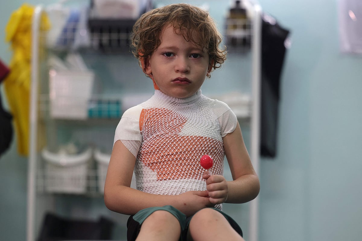 Four-year-old Yasser Khila is comforted with a lollipop after a dressing was applied to his wounds from spiled hot stew, at aclinic run by the charity Doctors Without Borders (MSF) in Gaza City on 7 September, 2022