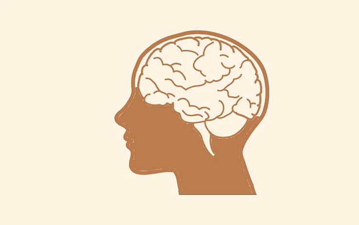 Representational image