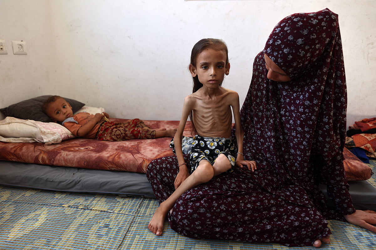 Nine-year-old malnourished Palestinian girl Mariam Dawwas sits on the floor with her mother in the Rimal neighbourhood in Gaza City on 2 August, 2025