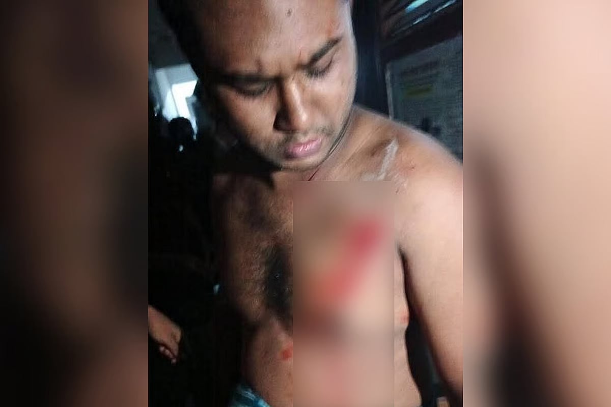 Injured student Rabiul Haque