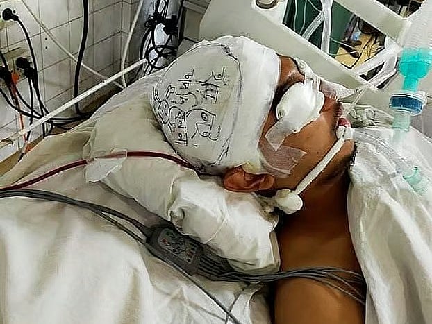 Mahadi J Akib at Chittagong Medical College Hospital.