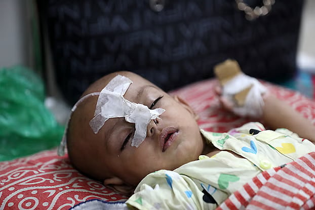 Children suffering from measles and measles-like symptoms are receiving treatment at the DNCC Dedicated COVID Hospital in the capital. Here is a picture of one such child undergoing treatment.
