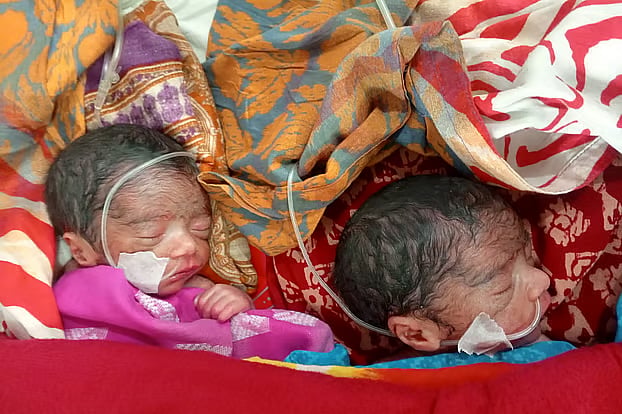 A pair of newborn twins undergoing treatment at Rajshahi Medical College Hospital’s ward no. 26.