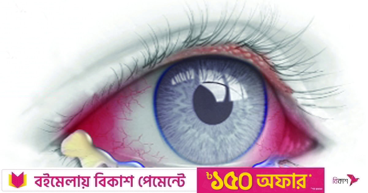 Ayollar hukmronligi porno video biseksuallar Elektr izolyatsiyalovchi yonginga qarshi qatlam